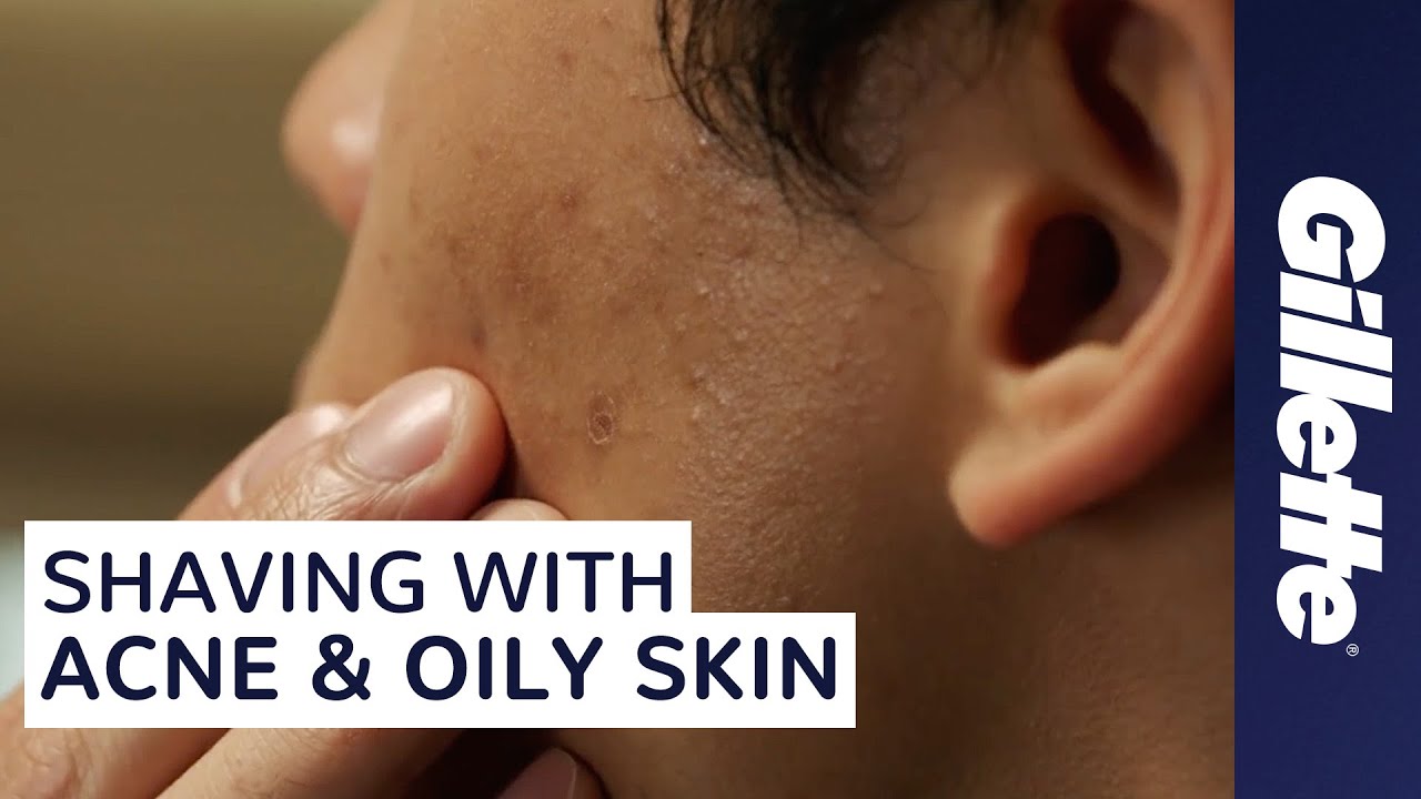 How to Avoid Shaving Irritation with Acne & Oily Skin Gillette YouTube