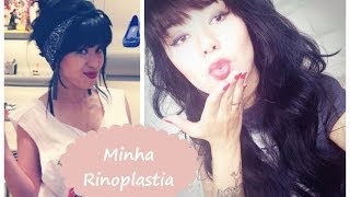 Sobre Minha Rinoplastia - Karen Portela