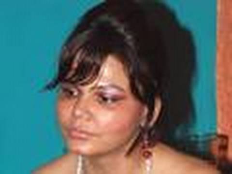 Rakhi Sawant's FAce Bad State!!! - YouTube