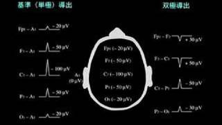 EEG in Japanese