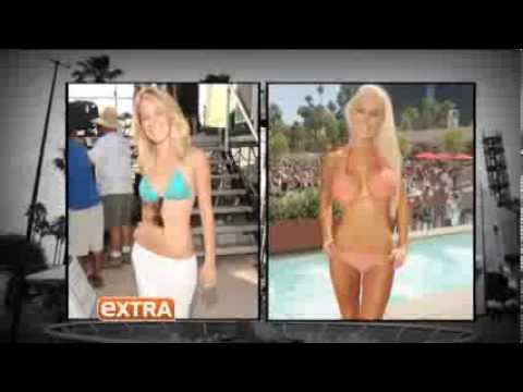Analyzing Hollywood, Inside the world of celebrity plastic surgery - 2013