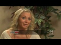 Video: Plastic Surgery - Dr Miller - Allison