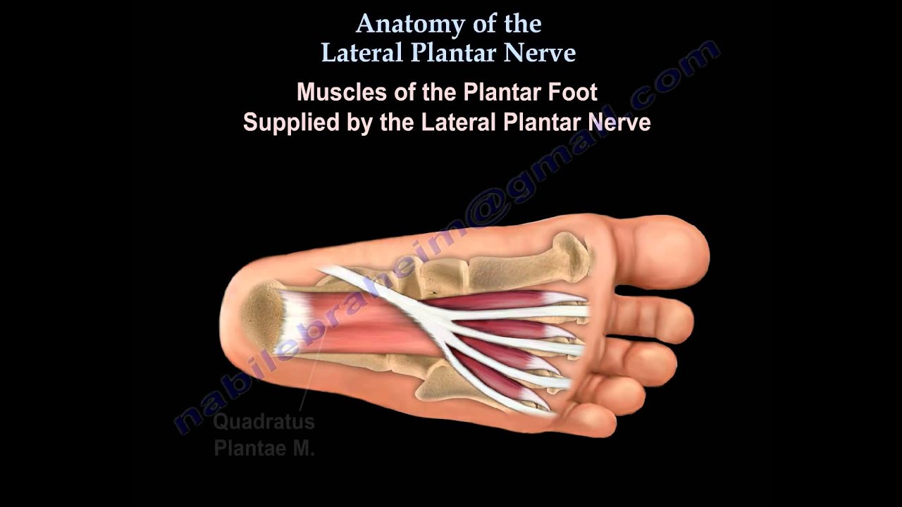 interdigital neuroma