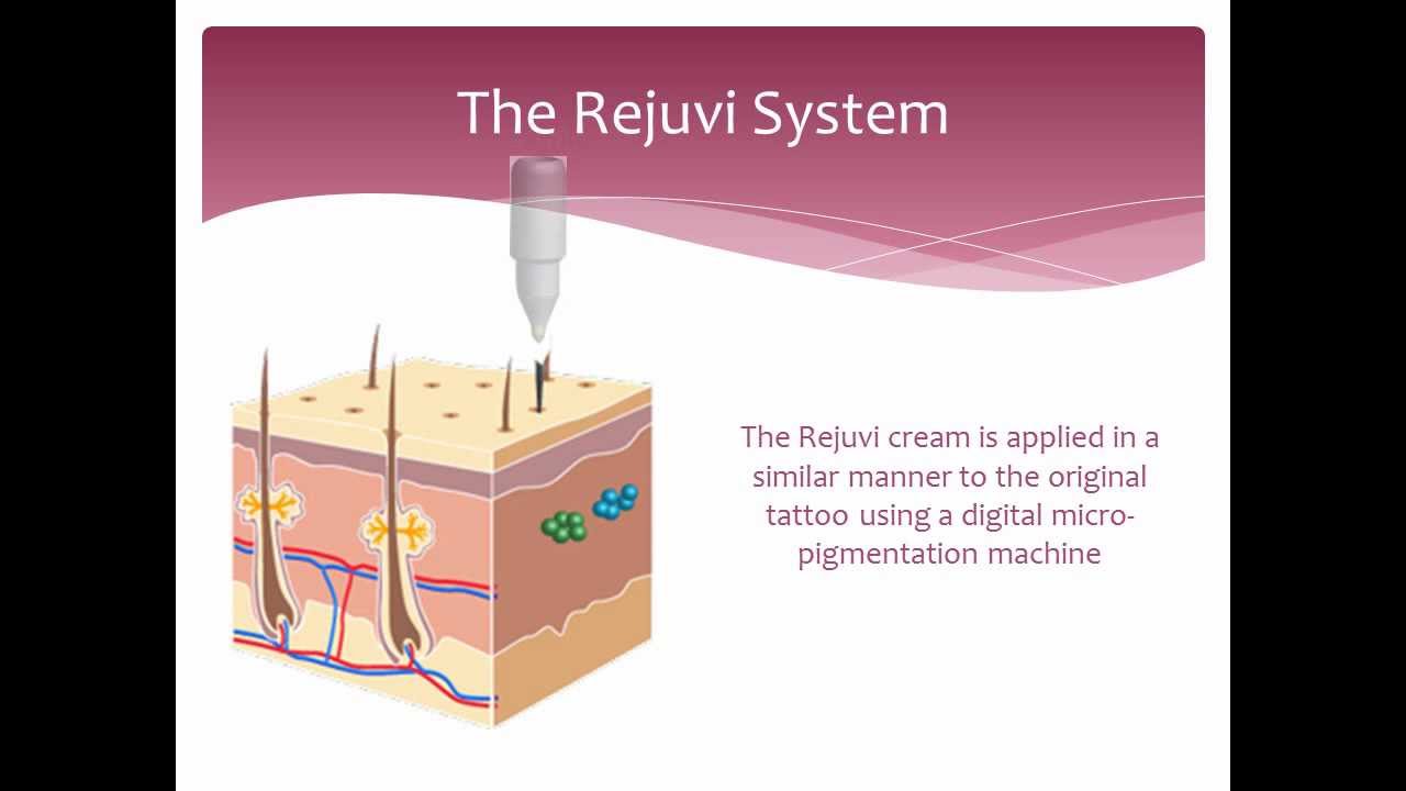 Tattoo Removal - Non laser - How it works - Rejuvi - YouTube