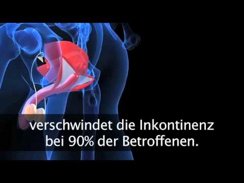 Von kreatin wird die Impotenz