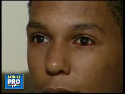 ولد يبكي دما 