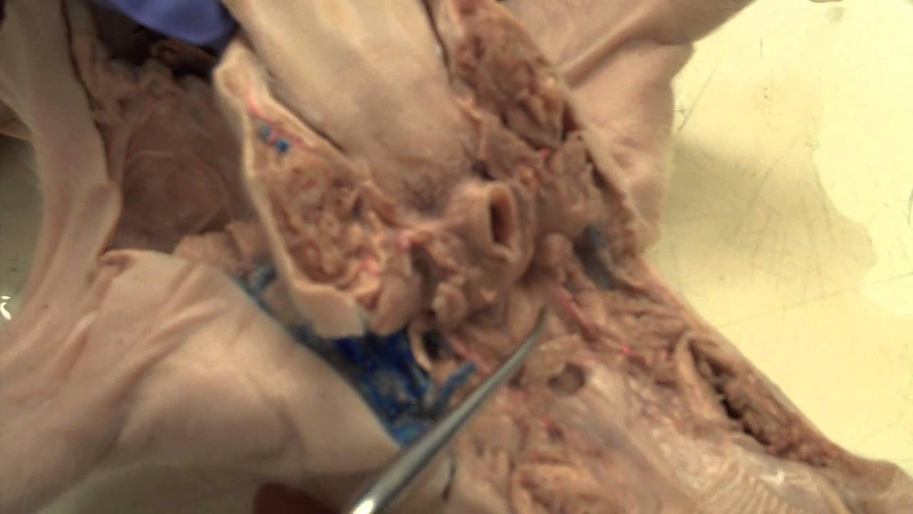 Anatomy of the Fetal Pig: Figure 3.2 Oral Cavity and Pharynx - YouTube
