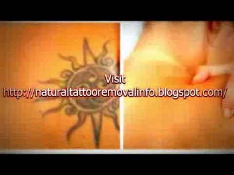 ... Tattoo at Home - Before and After Natural Tattoo Removal - YouTube