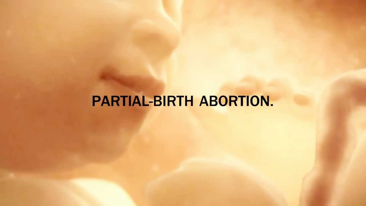 essays on partial birth abortion essays on partial birth abortion