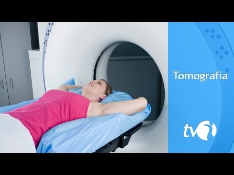 Tomografia: saiba como funciona o exame de imagem