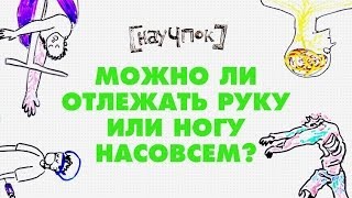 Можно ли отлежать руку или ногу насовсем?