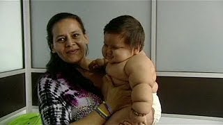 Colombia baby weighs record 21 kilos at only 8 months