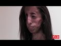 World's Thinnest Woman: Body Bizarre Episode 1