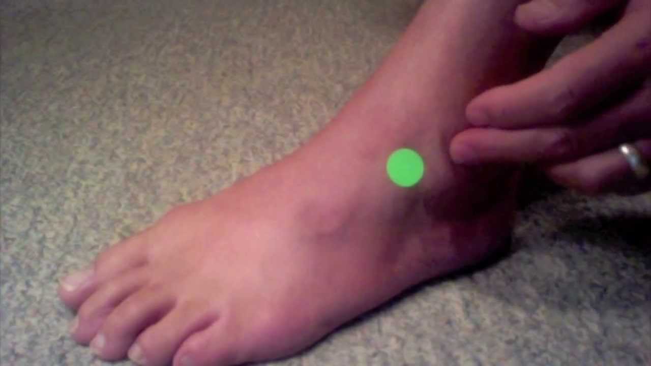 Ankle Sprain Relief Point - YouTube