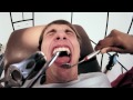 Fred Figglehorn - Don't Forget to Brush - Official Music Video