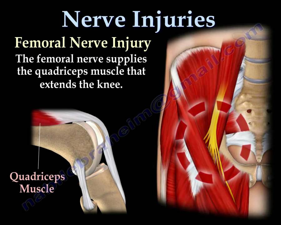 NERVE INJURIES,INJURY - Everything You Need To Know - Dr. Nabil