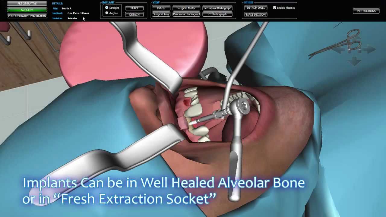 Real Dentist Surgery Simulator Videos