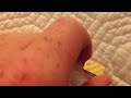1 gram gold bar Credit Suisse/ update on my gold collection