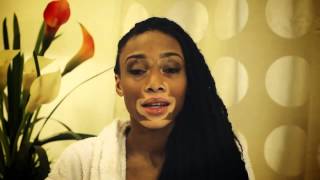 Chantelle Brown Young talk about vitiligo and her dream