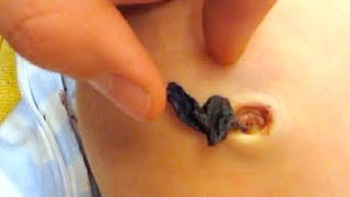 DISGUSTING BELLY BUTTON SCAB!