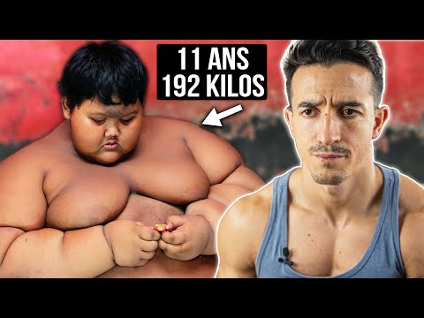 192 KILOS À 11 ANS : L'enfant le plus gros du monde