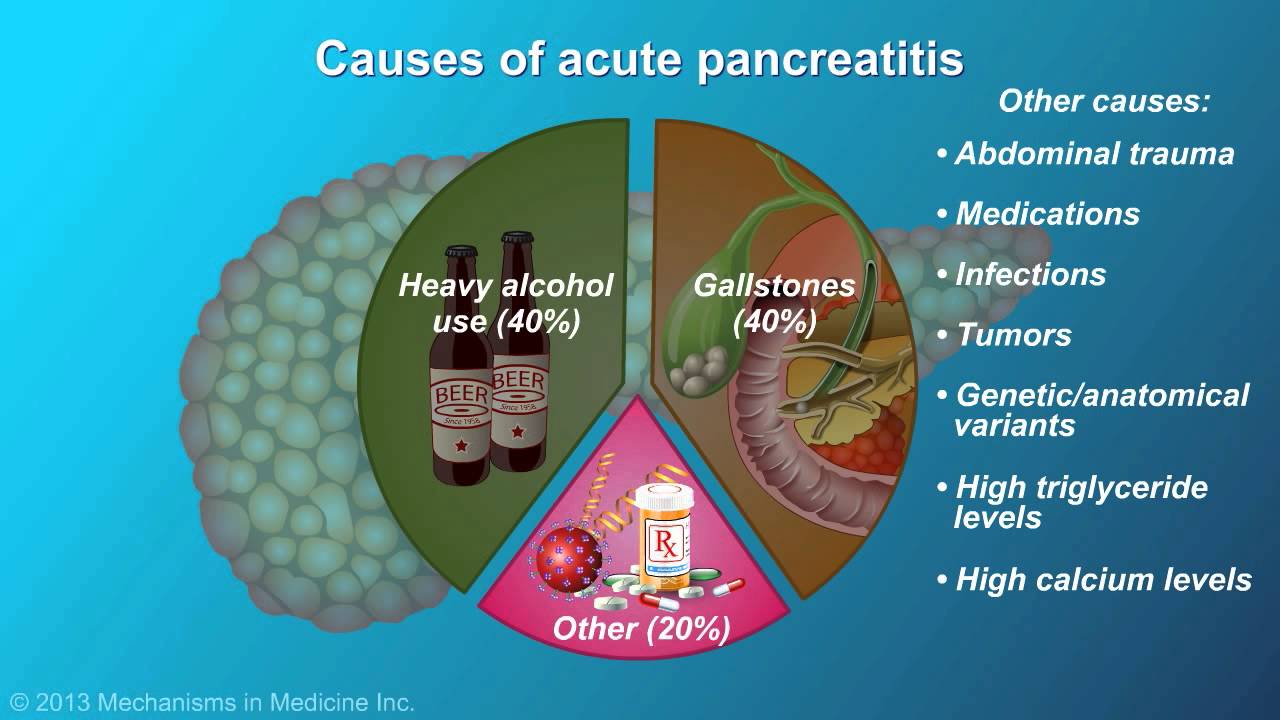 Acute Pancreatitis - YouTube