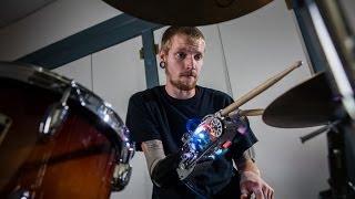 Robotic Drumming Prosthesis