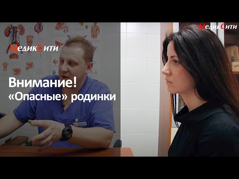 Невусы на теле лечение Невусы на теле лечение
