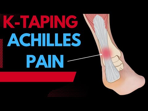 tape achilles tendonitis kinesiology treat toe using valgus hallux acti itpo