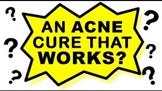 Acne No More Review | Inside Mike Walden's Acne No More Ebook