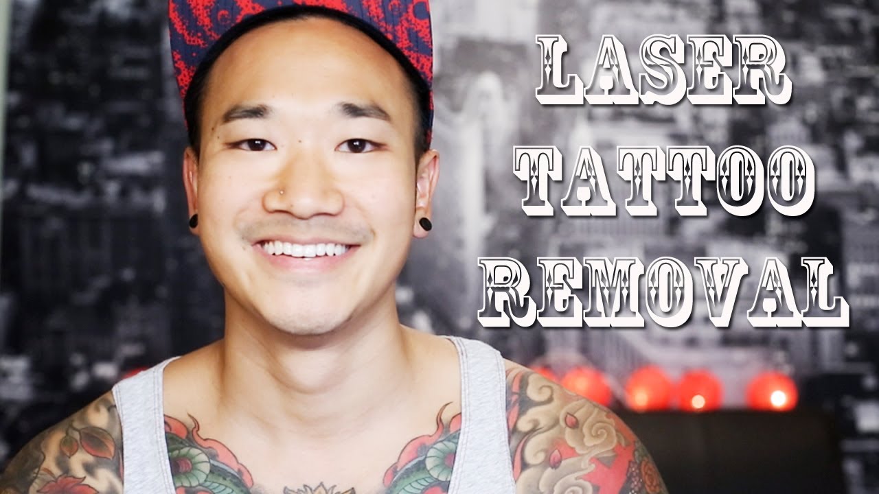 LASER TATTOO REMOVAL | MY EXPERIENCE - YouTube