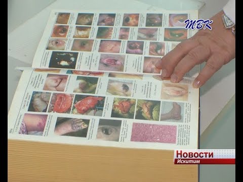 В Искитиме растет число онкологических больных