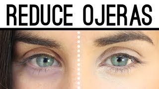 Reduce las ojeras