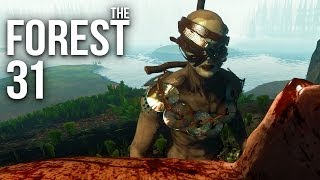 THE FOREST [HD+] #031 - Der Fuß zum Gruß ★ Let's Play The Forest