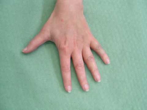 dislocate your thumb wikihow