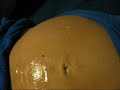 Baby Kicking Mother Hard. Fetal Doppler Heartbeat. Funny.