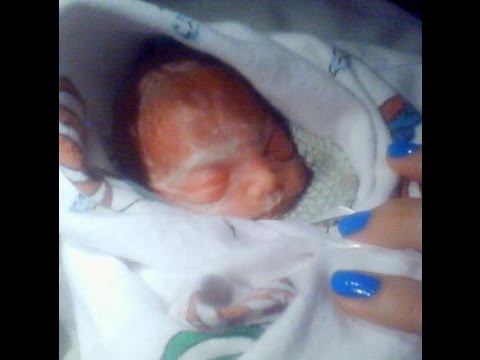 My Stillborn Story Including Pictures - YouTube