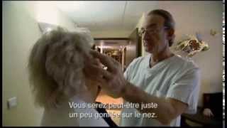 Lifting cervico-facial sur une femme de 78 ans