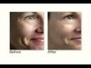 Artistry Time Defiance - Younger Acting Skin