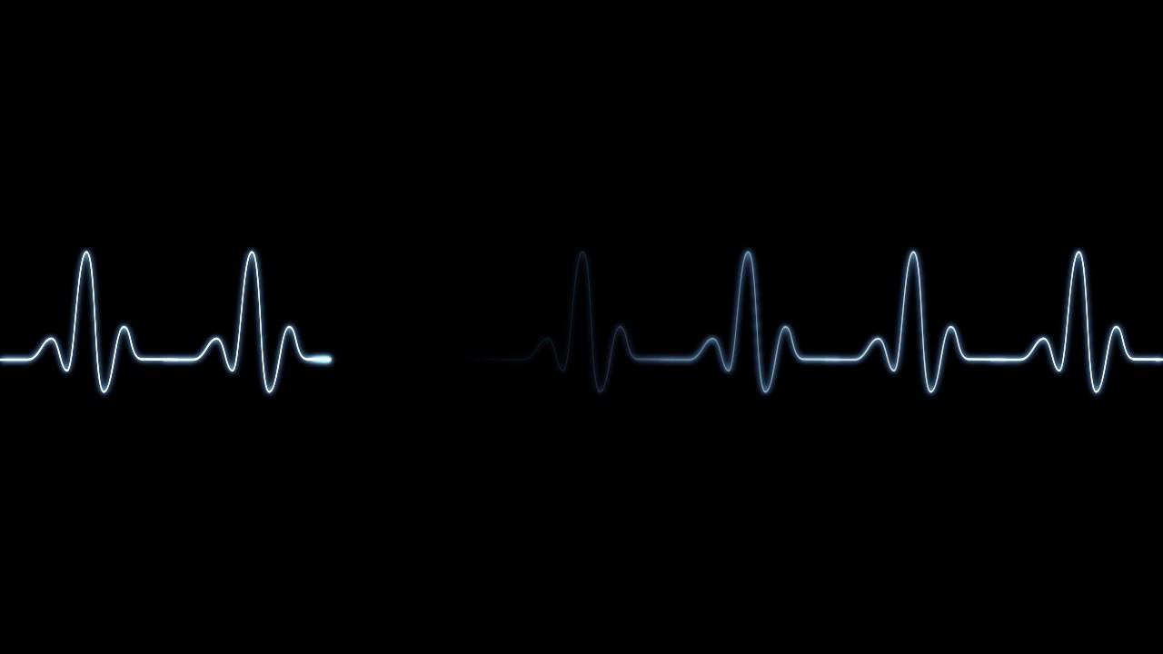 ECG Heartbeat - YouTube