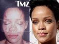 Rihanna Abuse Photo Reaction - Youtube