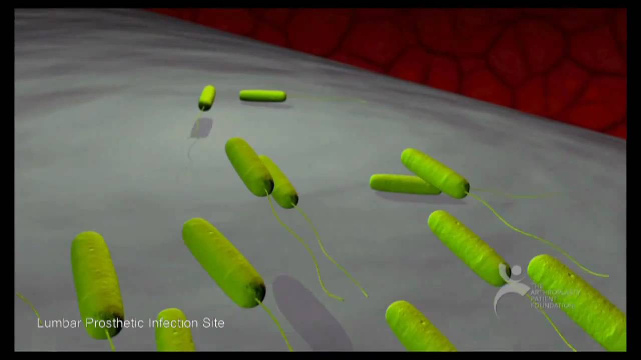 What Are Bacterial Biofilms? A Six Minute Montage - YouTube