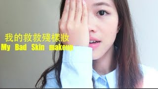 我的救救殘樣妝 My Bad Skin Makeup