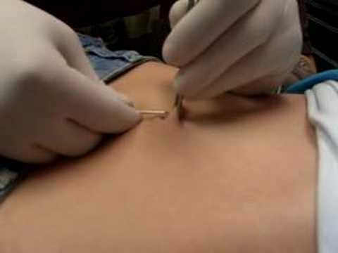 large hairy mole on face getting vagina pierce