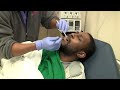 Dry Socket Emergency