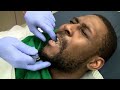 Dry Socket Emergency