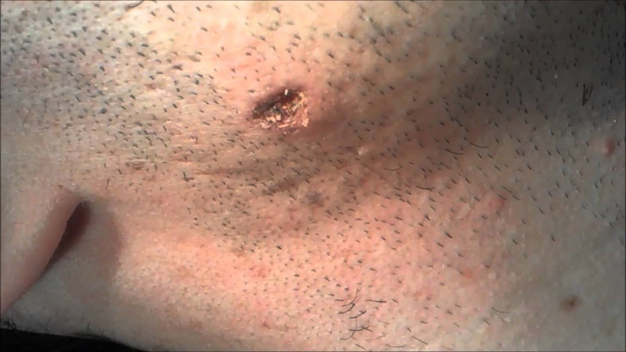 Dam Removal Gone Wrong