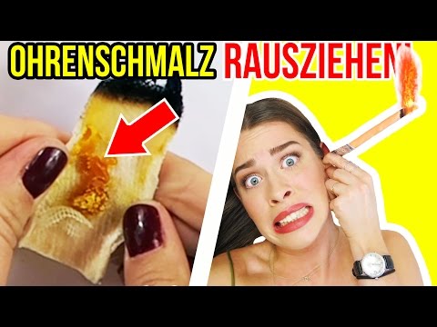 Download OHRENSCHMALZ ENTFERNEN EXTREM - mit KERZE! 😫 EKELHAFTES OHRENKERZEN ERGEBNIS im LIVE TEST!