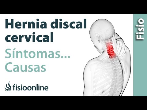Los métodos modernos del tratamiento de la osteocondrosis lumbar