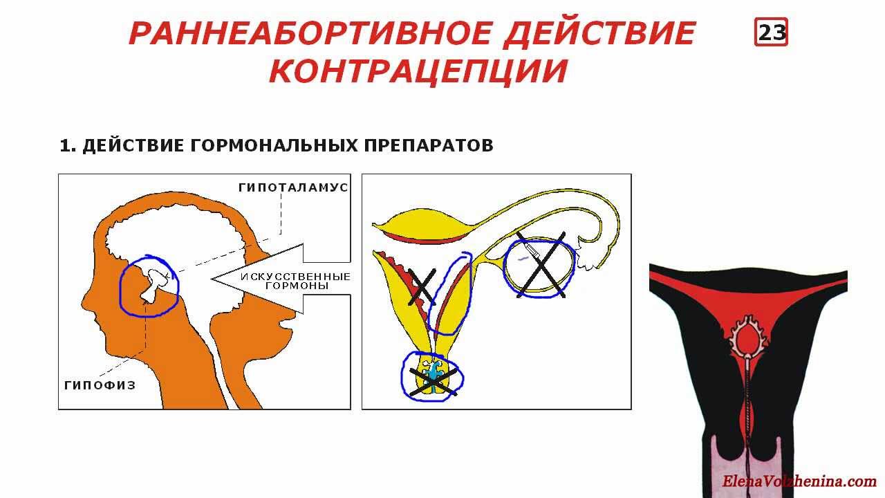 Мрп что это беременность Мрп что это беременность
